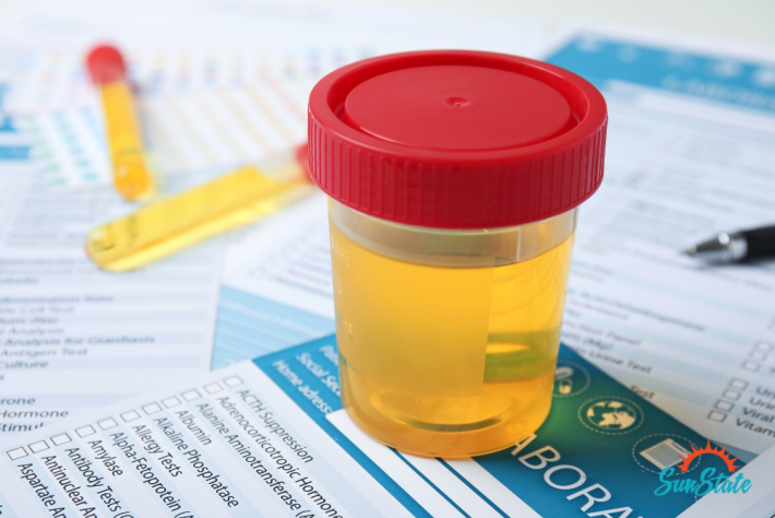 can dot drug test detect synthetic urine